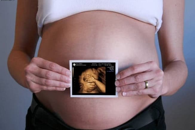 беременная держит фото УЗИ перед животом