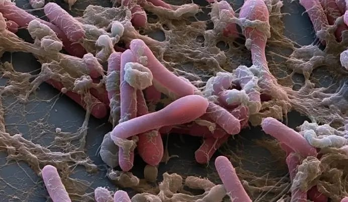 Clostridium botulinum. Увеличение х8000 раз. Clostridium botulinum. Увеличение х8000 раз.